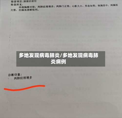 多地发现病毒肺炎/多地发现病毒肺炎病例-第3张图片