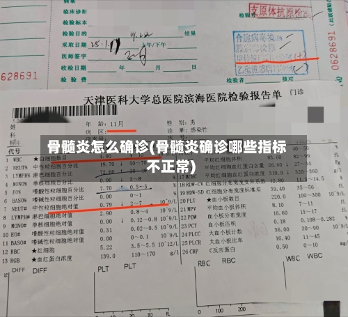 骨髓炎怎么确诊(骨髓炎确诊哪些指标不正常)-第3张图片